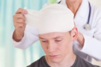 Brain Injury from San Diego Car Accidents